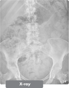 x-ray-image